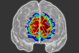 brain-perceives-unexpected-pain-more-strongly-study